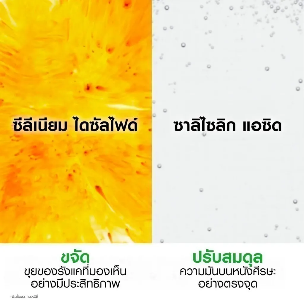 ICHY DERCOS ANTI-DANDRUFF SHAMPOO แชมพูขจัดรังแค พร้อมบำรุงหนังศีรษะ