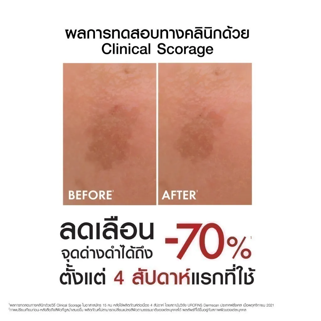 ผลการทดสอบทางคลินิกด้วย Clinical Scorage