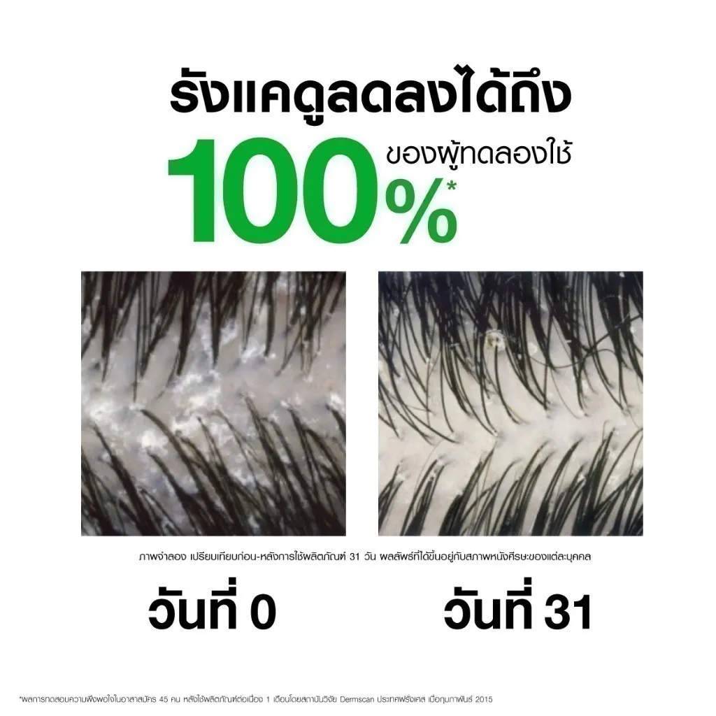 รังแคดูลดลงได้ถึง 100%