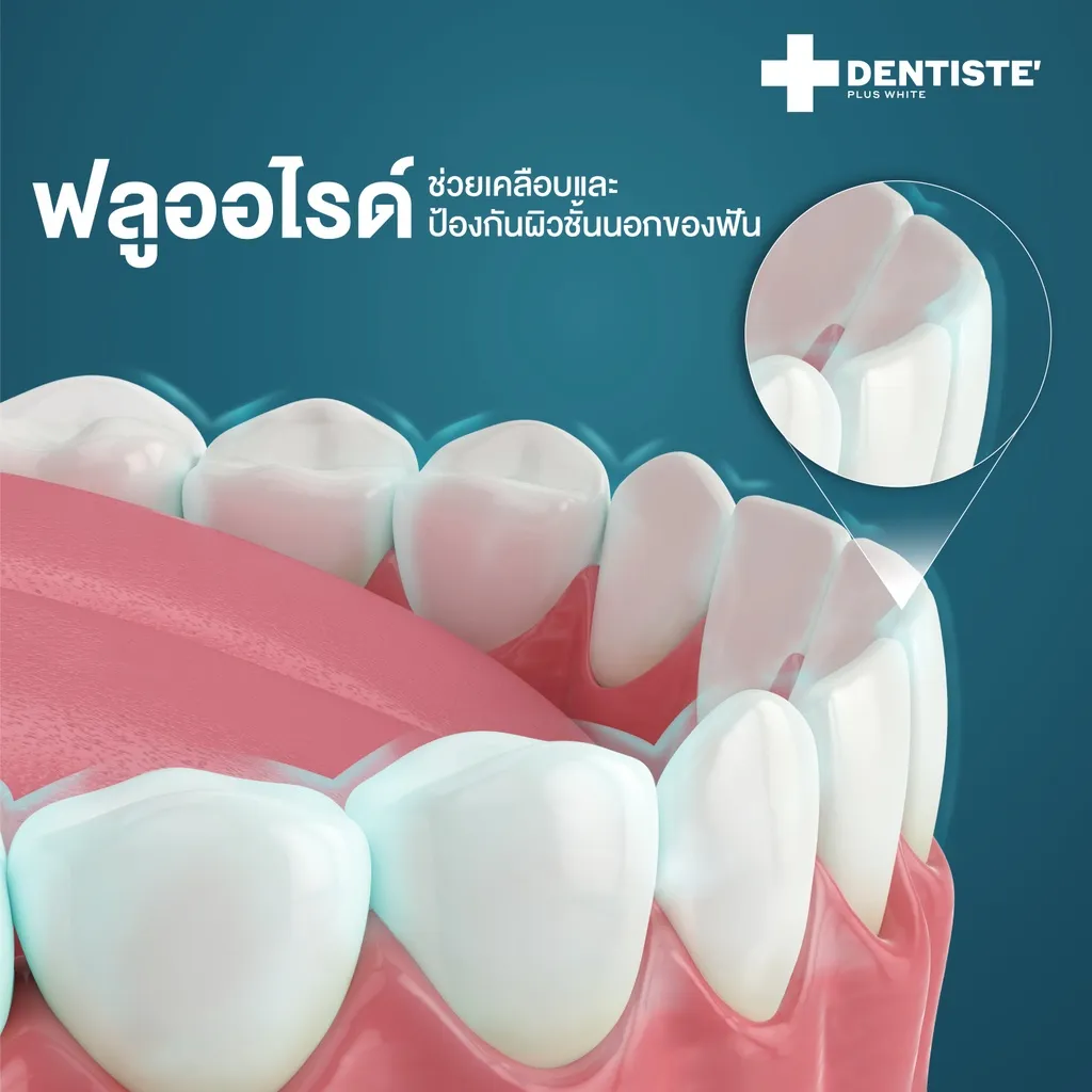 ภาพกราฟิกแสดงการทำงานของฟลูออไรด์ใน Dentiste ยาสีฟัน ลดเสียวฟัน เพื่อเคลือบและป้องกันผิวฟัน