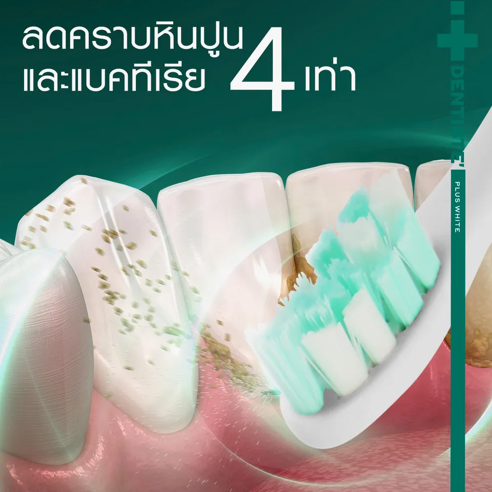 ภาพกราฟิกแสดงการทำงานของ Dentiste แปรงสีฟันไฟฟ้า โซนิค ในการลดคราบหินปูนและแบคทีเรีย