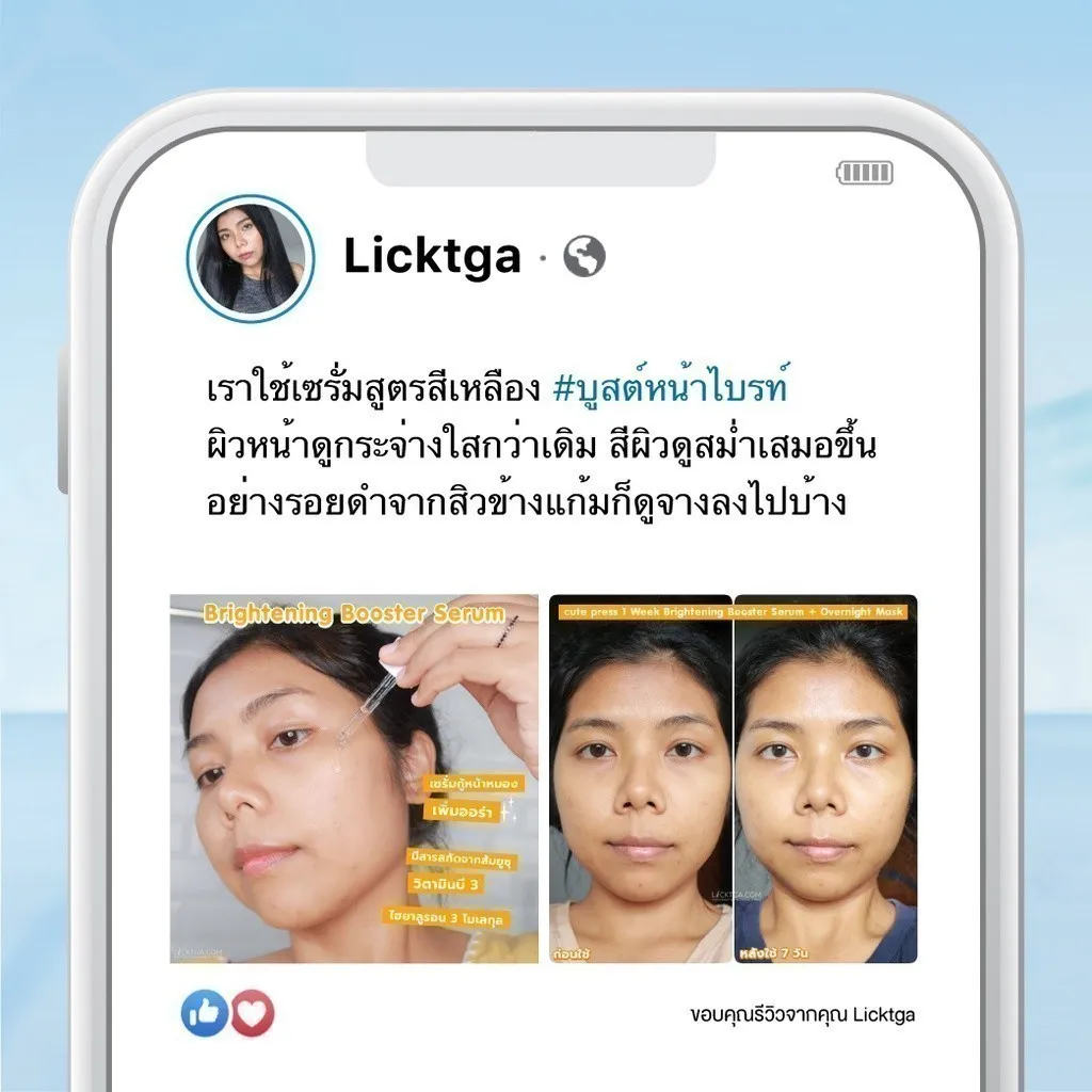 ภาพรีวิวจากผู้ใช้จริง หลังใช้เซรั่มบูสเตอร์สูตรไบรท์เทนนิ่ง ช่วยให้ผิวกระจ่างใส สีผิวสม่ำเสมอ รอยดำดูจางลง