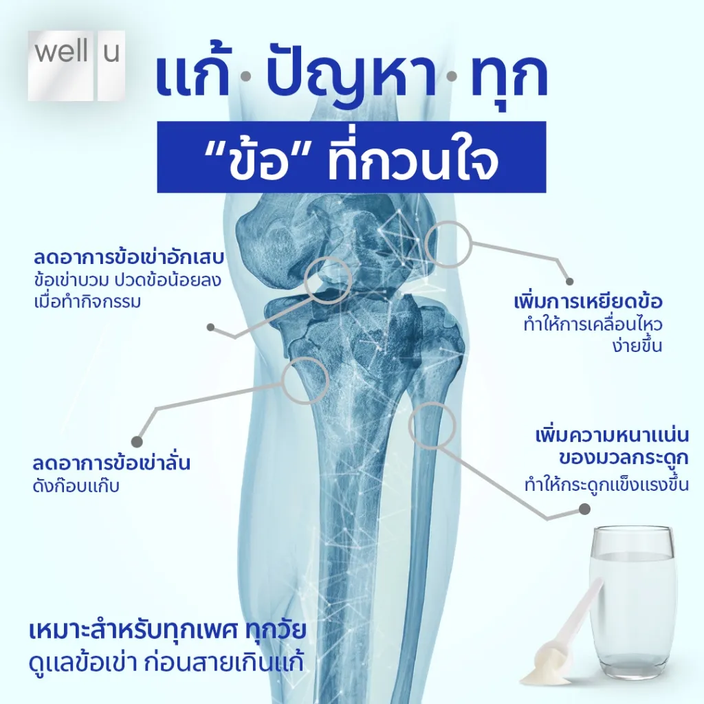 อินโฟกราฟิกจุดบรรเทาเข่าอักเสบ เพิ่มการเหยียดข้อต่อ และเพิ่มความหนาแน่นกระดูก