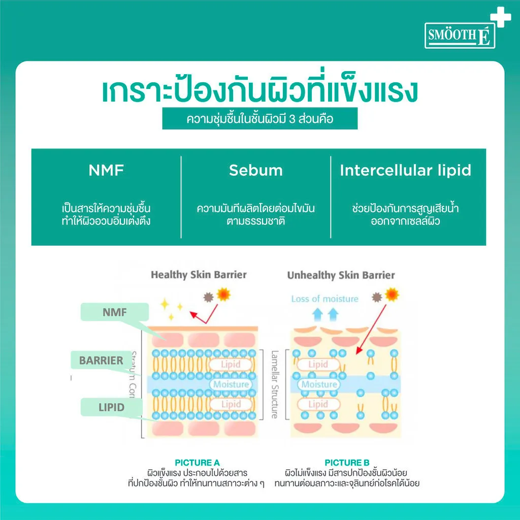 ตารางเปรียบเทียบโครงสร้างเกราะป้องกันผิวแข็งแรงกับผิวบอบบางโดยเน้นเอ็นเอ็มเอฟซีบัมและลิพิดระหว่างเซลล์