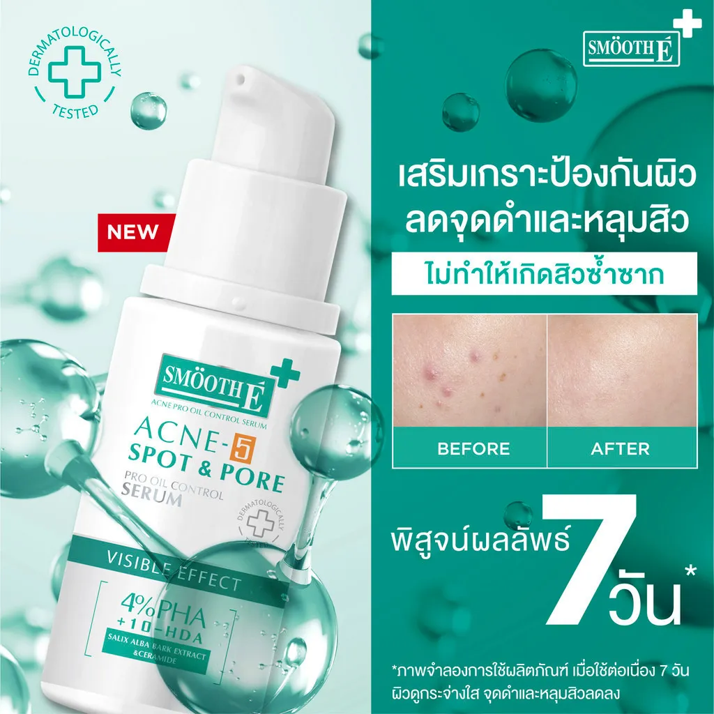 ขวด เซรั่มลดสิว Smooth E Acne 5 เอนเอียงอยู่หน้าพื้นสีเขียวคู่กับช่องเปรียบเทียบก่อนหลังใช้และคำเคลมเห็นผลเจ็ดวัน
