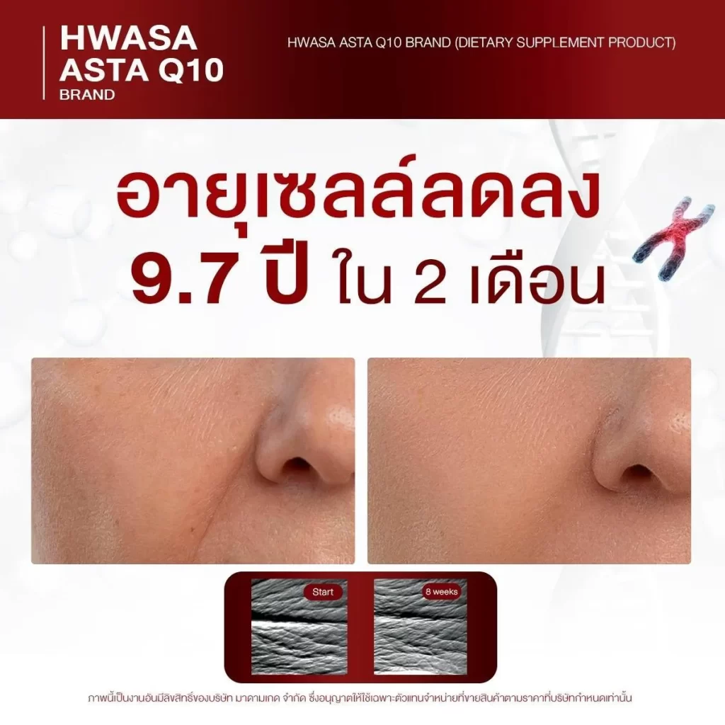 เปรียบเทียบผิวหน้าใกล้จมูกก่อนและหลัง 8 สัปดาห์ ริ้วรอยตื้นลง