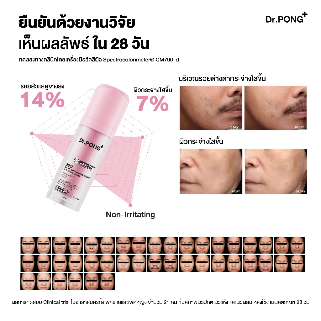 ผลทดสอบ เซรั่ม dr pong 28d ผิวขาว 28 วัน แสดงกราฟและผลก่อนหลัง รอยสิวหมองคล้ำลดลง