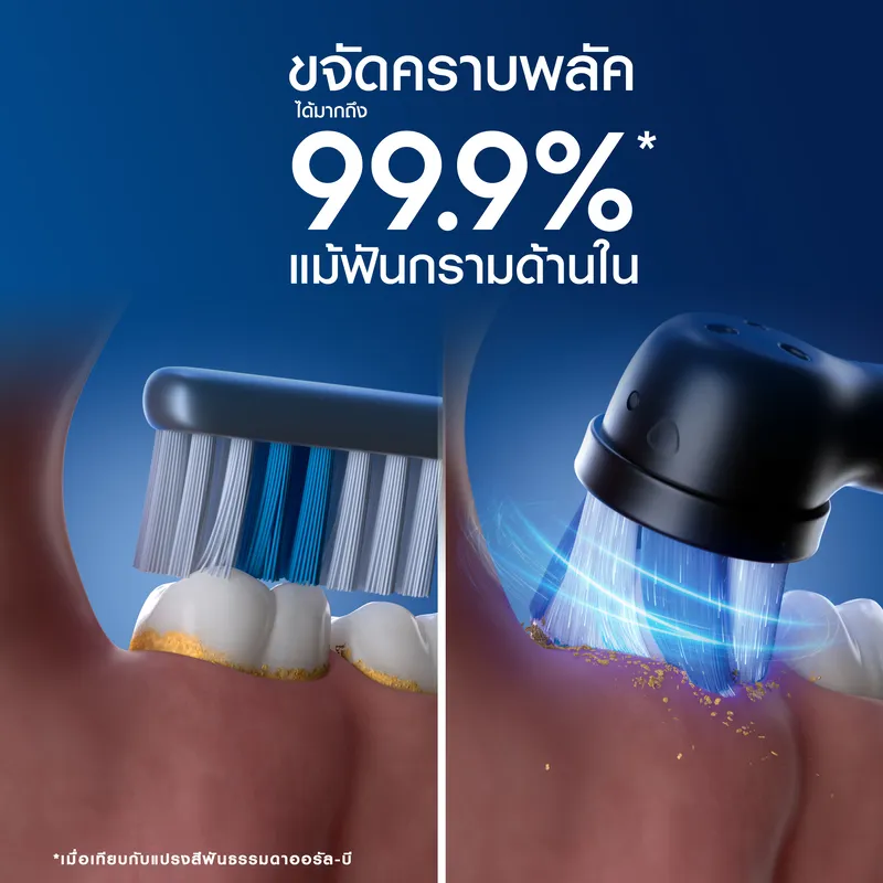 กรอบเปรียบเทียบคราบพลัคบนฟัน ระหว่างการทำความสะอาดแบบธรรมดากับแบบสั่น ช่วยเก็บรายละเอียดซอกฟัน