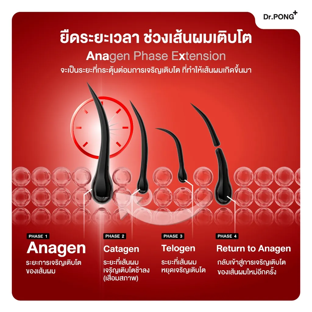 กราฟิกอธิบายวงจรเส้นผม 4 ระยะ พร้อมคำอธิบายการยืดระยะการเติบโต ระบุ Dr PONG ANA X 30 มุมบน