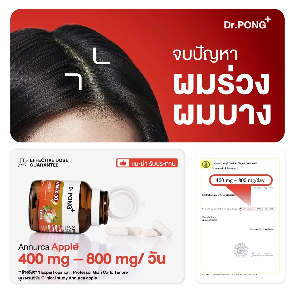 แบนเนอร์พื้นแดงมีภาพหนังศีรษะและข้อความจบปัญหาผมร่วงผมบาง พร้อมกรอบแนะนำขนาดรับประทานของ Dr PONG ANA X 30